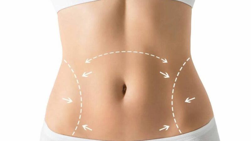 Пластика живота в Краснодаре: цены на абдоминопластику в клинике Medeast
