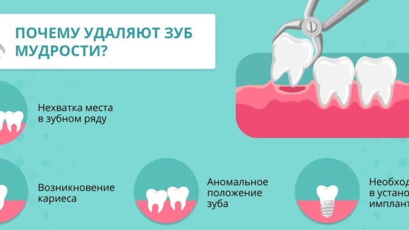 Удаление зуба мудрости советы подготовка и восстановление после процедуры